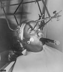 Thế kỷ trước, các bác sĩ sử dụng công nghệ đóng băng CO2 để loại bỏ tàn nhang, làm đẹp cho phụ nữ.