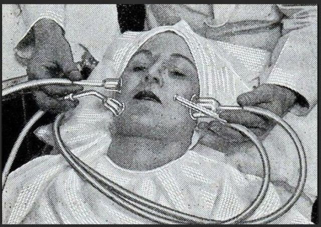 Những ống hút dạng cốc này có thể loại bỏ các đốm da chết xấu xí.