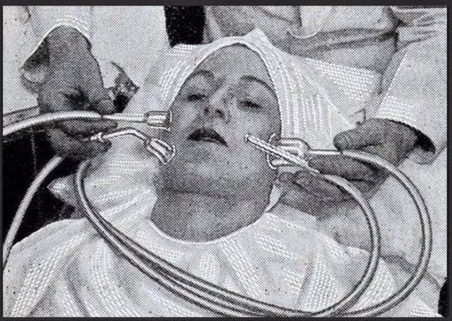 Những ống hút dạng cốc này có thể loại bỏ các đốm da chết xấu xí.