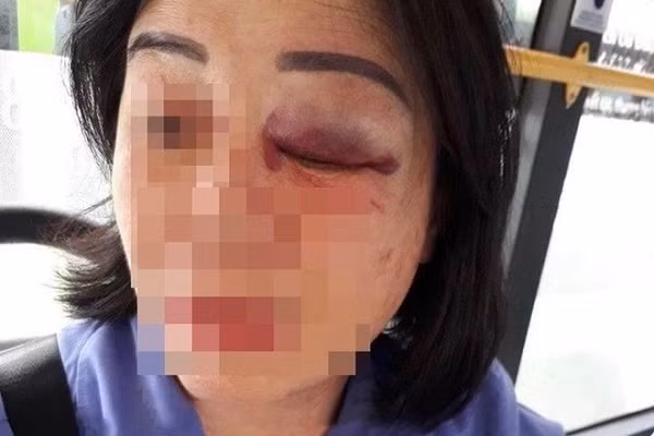 Cong an vao cuoc vu nhan vien xe buyt o TP.HCM bi tan cong