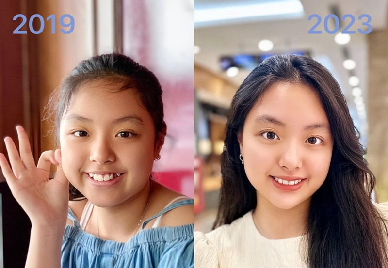  Sao nhí "Bố ơi, mình đi đâu thế" "lột xác" ngoạn mục. Một trong những lý do khiến Suti có nhiều thay đổi trên gương mặt là cô nhóc đã niềng răng. Ảnh: FBNV.