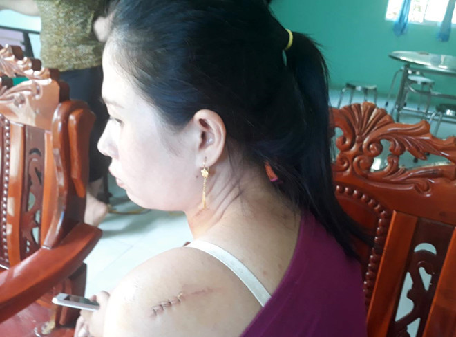 Phut kinh hoang cua co dau bi chong cu ruot chem tai tiec cuoi-Hinh-2