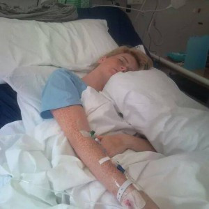 Hàng ngày, Jodie phải uống tới 17 loại thuốc kháng sinh. Sau khi ra viện, cô phải chịu thêm hội chứng rụng tóc và viêm phổi do hệ miễn dịch đã suy yếu.