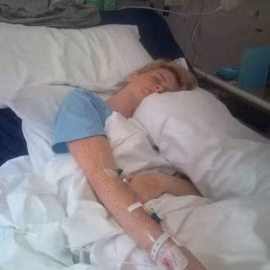 Hàng ngày, Jodie phải uống tới 17 loại thuốc kháng sinh. Sau khi ra viện, cô phải chịu thêm hội chứng rụng tóc và viêm phổi do hệ miễn dịch đã suy yếu.