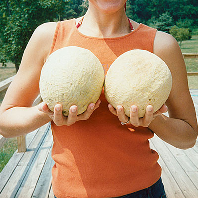 Theo số liệu của Hiệp hội phẫu thuật thẩm mĩ Mỹ, năm 2014 đã có hơn 114.000 trường hợp phẫu thuật thu nhỏ ngực và là loại phẫu thuật đươc thực hiền nhiều thứ 8 tại quốc gia này.