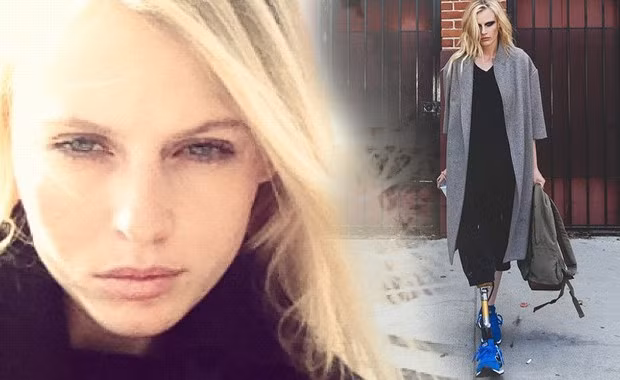 Hội chứng này khiến cô bị tổn thương một số bộ phận cơ thể và bị đau tim.