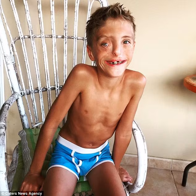 Thay vì chạy trốn và tự ti về bản thân, Zak thường xuyên tươi cười khi gặp những ánh nhìn dò xét, tò mò.