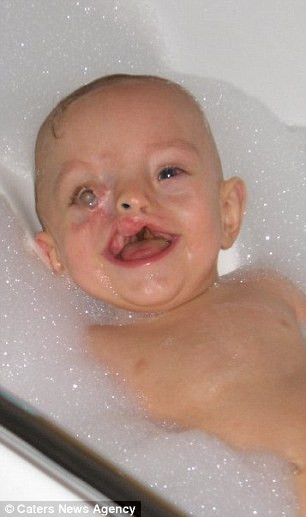 Theo mẹ của Zak Lynthgoe, bà không hề biết đến bệnh tình của con mình lại nghiêm trọng đến thế cho đến khi sinh con ra.