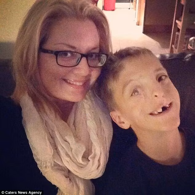 Sau khi trải qua khoảng 13 cuộc phẫu thuật, ở tuổi thứ 9, Zak đã có được nụ cười khá hoàn thiện.