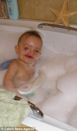 Dù ở tuần thai 22, bà đã được cảnh báo về khả năng con mình bị hở hàm ếch sau khi bác sĩ siêu âm thai nhi.