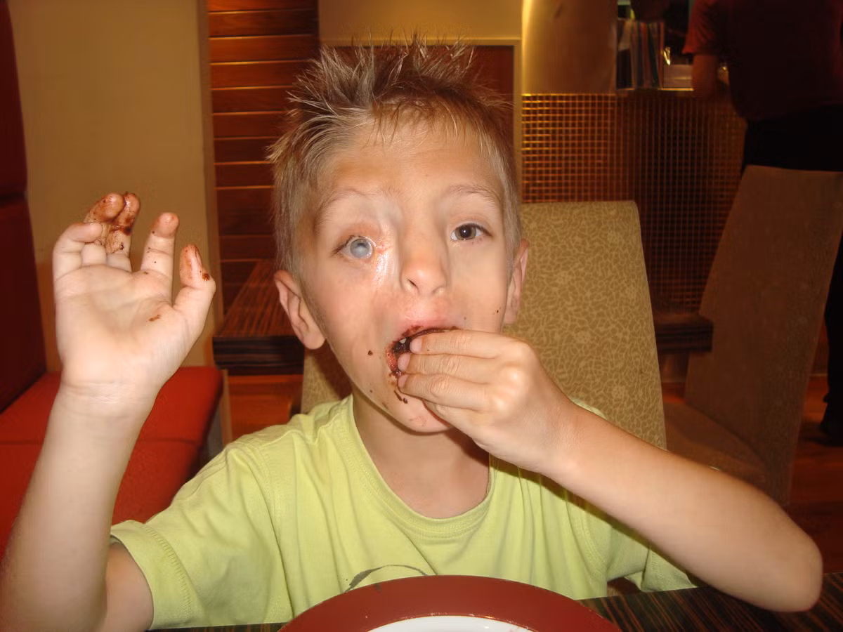 Và câu chuyện về nghị lực sống và thái độ lạc quan của "cậu bé quái vật"có thể sẽ tiếp sức thêm cho những hoàn cảnh tương tự.