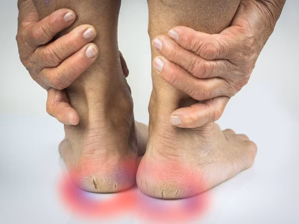 Kem chống hăm là một trong nhiều biện pháp làm đẹp mà ít người nghĩ tới. Khi gót chân bị nứt nẻ, hãy bôi kem này vào, đảm bảo bạn sẽ không còn phải khó chịu về tình trạng khô da tới nứt nẻ ở gót chân.