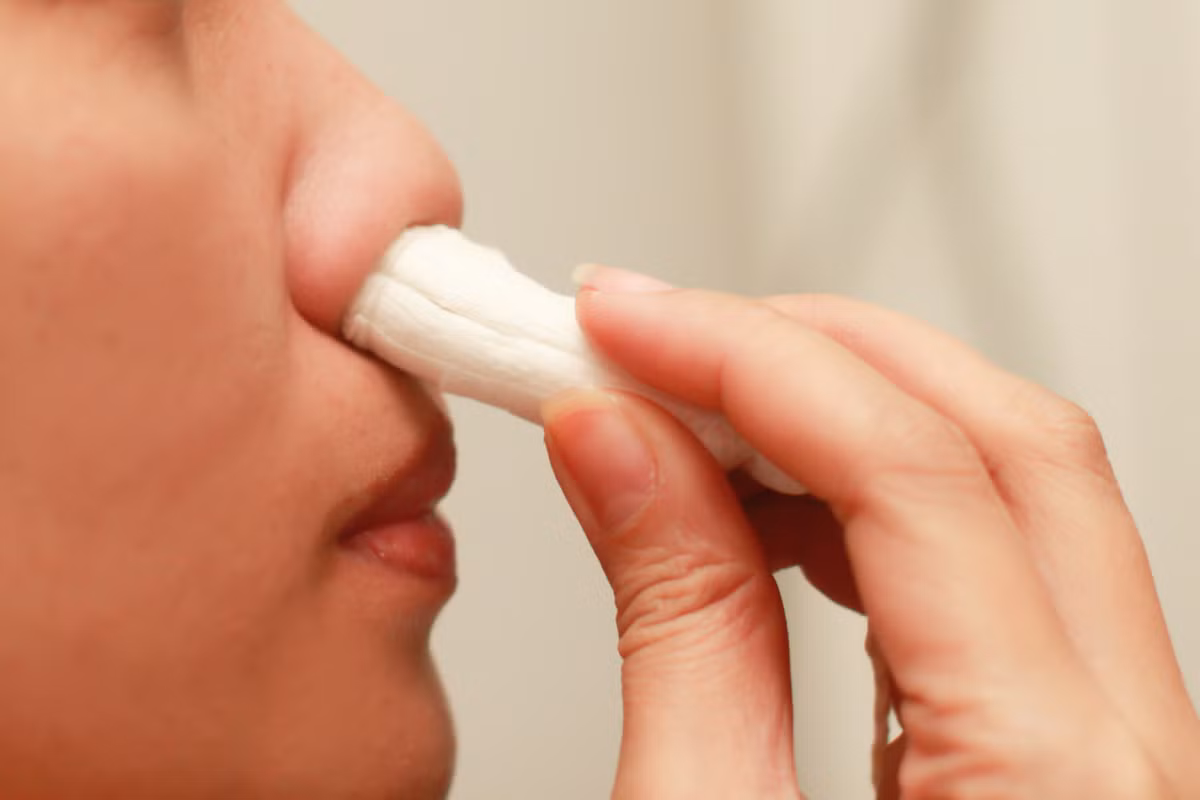 Sau đó hơi cúi đầu về phía trước. Việc này giúp máu ở mũi chảy ra ngoài, thay vì chảy vào cổ họng.