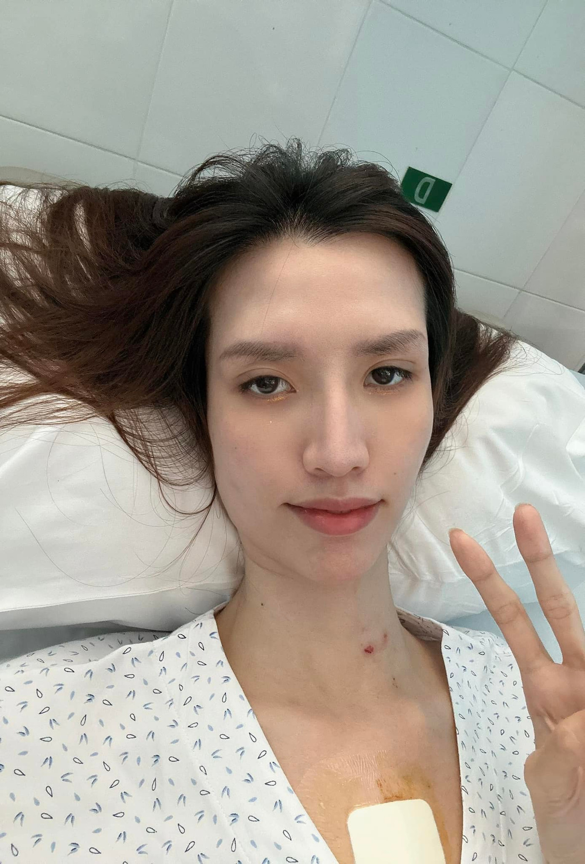 Mới đây, Hồng Xuân hoàn thành ca phẫu thuật thay van tim. Ảnh: FBNV