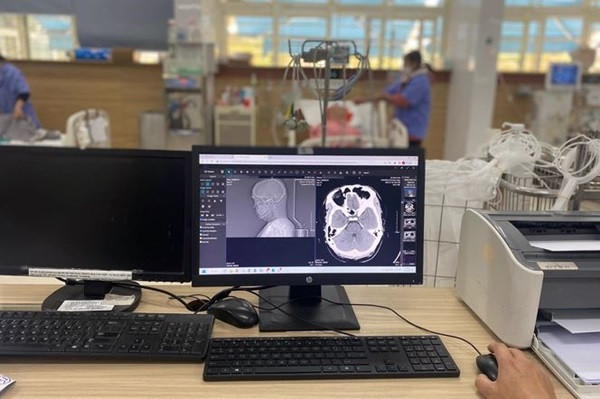 Nam thanh nien bi dot quy nao chi vi uong nhieu ruou