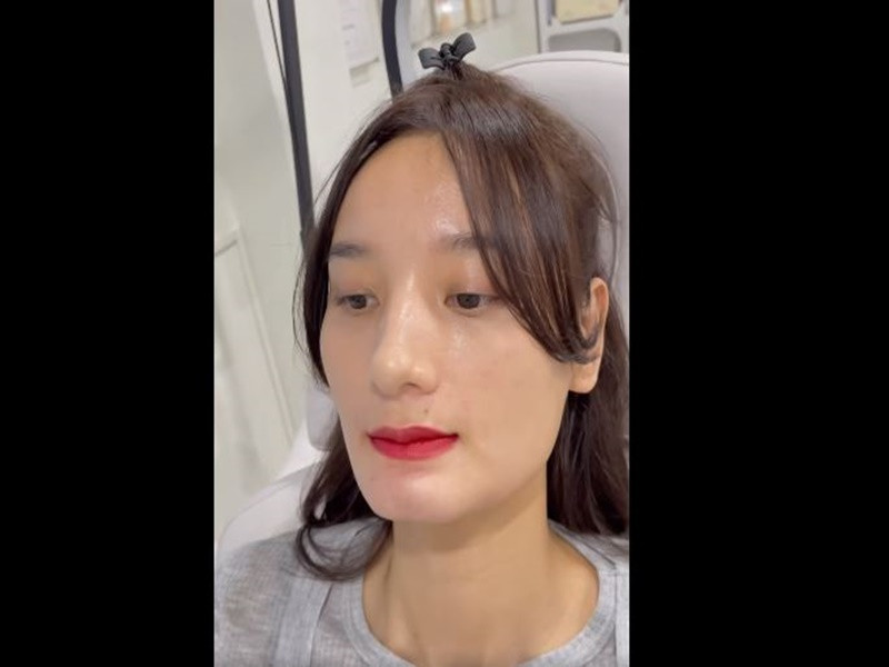 Lê Thúy tiêm filler một chút để giữ lại được chiếc cằm chẻ.