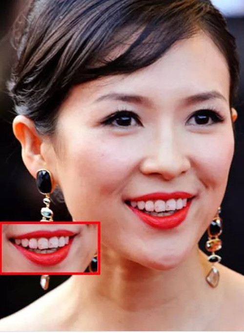 Tham dự Liên hoan phim Cannes 62 tại Pháp, Hoa đán Chương Tử Di kém duyên khi xuất hiện với hàm răng lem son đỏ.