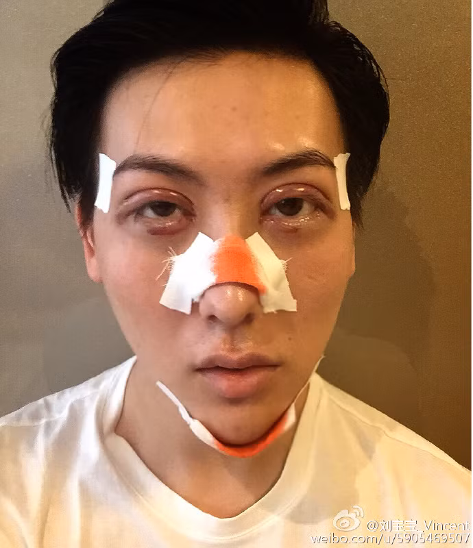 Không chỉ phẫu thuật một mình, Lưu Tử Thần còn có một hội bạn được mệnh danh là "búp bê" với những cô nàng cũng có khuôn mặt dị dạng không kém gì "mặt rắn".