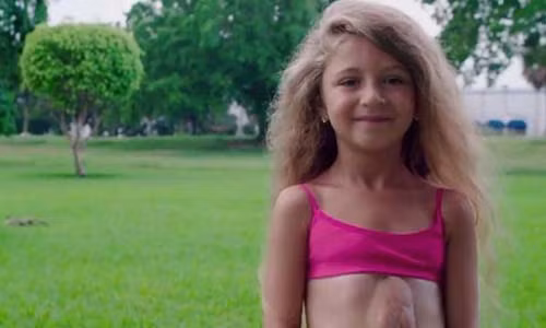 Suc song ky dieu cua be gai co tim moc ngoai long nguc