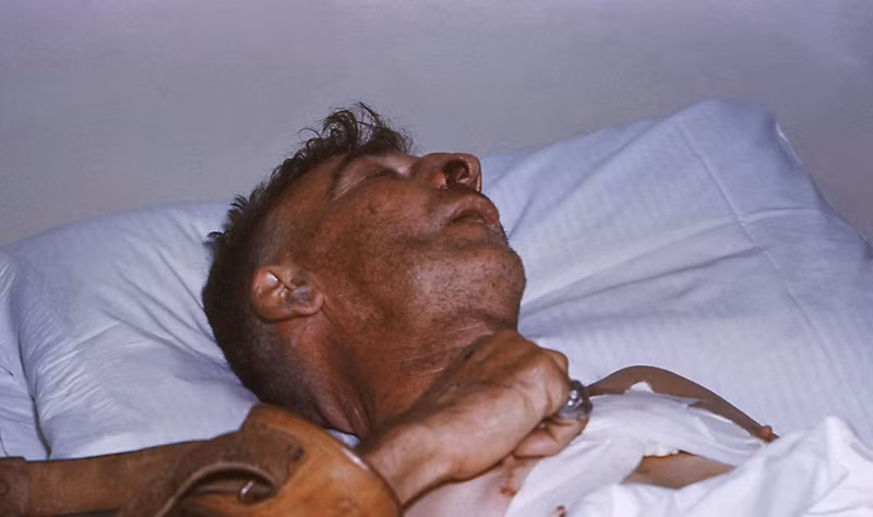 Nhung dieu phai biet ve benh dai o nguoi-Hinh-3