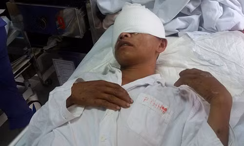 Bệnh nhân Ký đang điều trị ở bệnh viện.