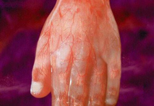 Những mạch máu ở bàn tay thai nhi rất rõ rệt vì thời điểm này, thai còn nhỏ, làn da mỏng. Tuy nhiên, các ngón tay đã đầy đủ bộ phận.