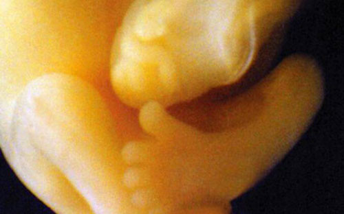 Hình chụp bàn chân đã phát triển đầy đủ các ngón của một thai nhi trong bụng mẹ.