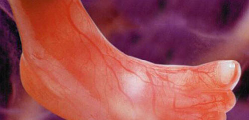 Ảnh siêu âm bàn chân một thai nhi.