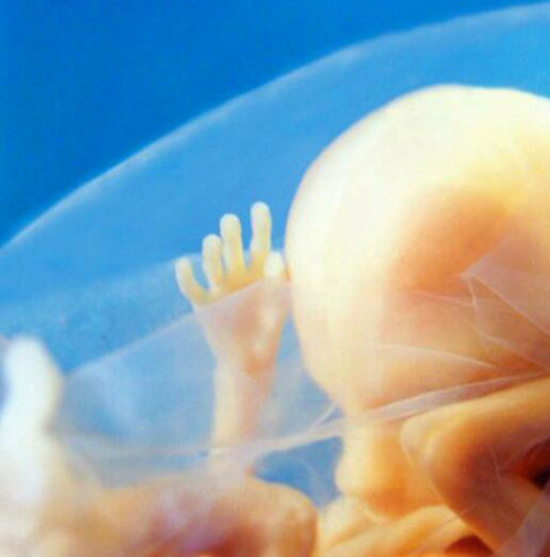 Siêu âm thai nhi là một bước tiến lớn trong lịch sử y học.