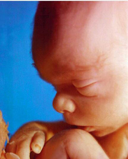 Nhờ công nghệ siêu âm ngày một tiên tiến, các bác sĩ có thể chụp lại những khoảnh khắc không thể chân thực hơn của thai nhi trong bụng mẹ.