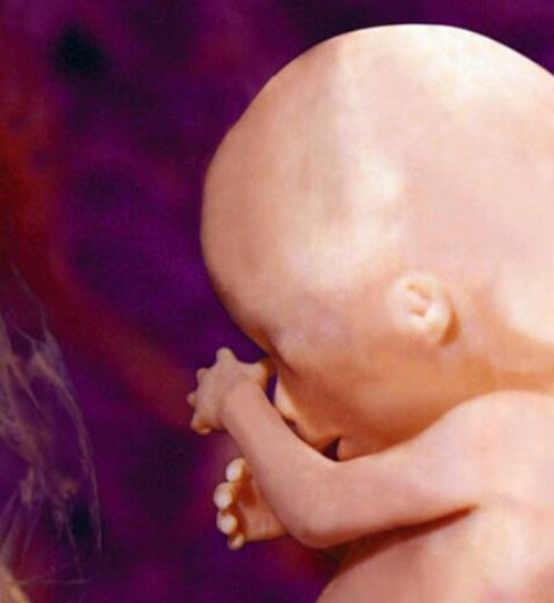 Hình chụp toàn thân một thai nhi chưa phát triển đầy đủ nhưng các bộ phận hình thù cơ bản đã khá rõ.