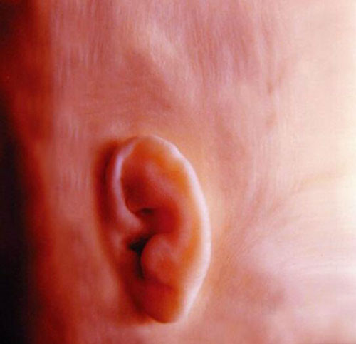 Vành tai em bé đã hoàn thiện gần như hoàn toàn, có thể thấy được cả những lông tơ trên da đầu.