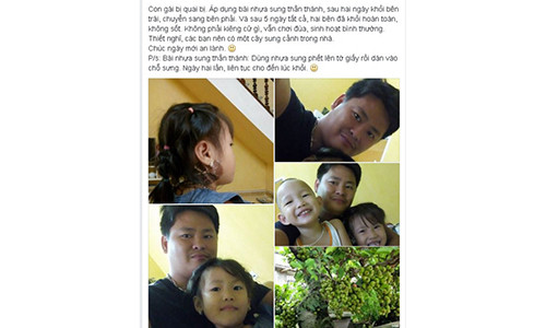 Meo chua quai bi cho con chi 5 ngay khong can kieng