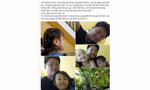 Meo chua quai bi cho con chi 5 ngay khong can kieng