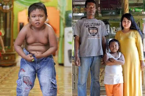 Quay trở lại với Ardi, do nghiện thuốc lá từ khi quá trẻ nên việc cai nghiện của cậu bé cực kỳ khó khăn. Để thay thế cho khói thuốc, Ardi sử dụng thực phẩm để đè nén thói quen của mình. Tiếc thay, sự đè nén này khiến Ardi vướng phải chứng thèm ăn vô độ. Cậu bé thèm ăn liên tục các loại đồ ăn vặt và không thể dừng lại.