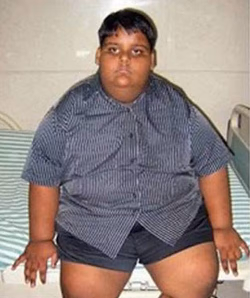 Chính vì thế, cai nghiện được thuốc lá, Ardi lại mắc bệnh béo phì. Bệnh béo phì ảnh hưởng đến sức khỏe và hoạt động của Ardi trầm trọng, khiến cậu bé tiếp tục bước vào một cuộc điều trị riêng biệt khác nhằm khắc phục những vấn đề liên quan đến chứng thèm ăn vô độ của mình. Tiến sĩ Kak Seto, bác sĩ tâm lý, người điều trị chính cho Ardi cho biết, ông phụ trách vấn đề trị liệu, giúp cho tâm trí của Ardi thoải mái, không còn bị ám ảnh bởi những vấn đề liên quan đến nghiện ngập và thèm muốn thứ vật chất khác thay thế. Bên cạnh đó, có một chuyên gia dinh dưỡng giúp đỡ để lên thực đơn lành mạnh cho Ardi.