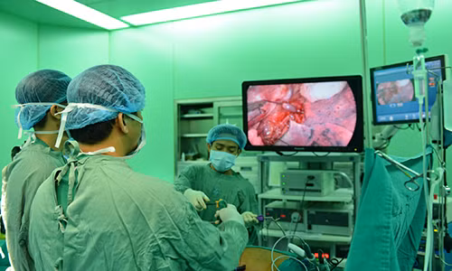 Noi soi dieu tri ung thu da day