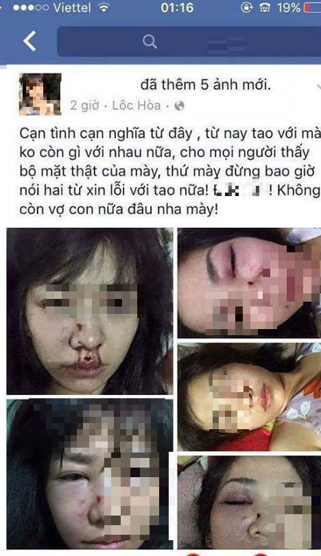 Dòng status kèm hình ảnh bị "ăn đòn" của cô gái trẻ gây bức xúc (Ảnh: Beat.vn).