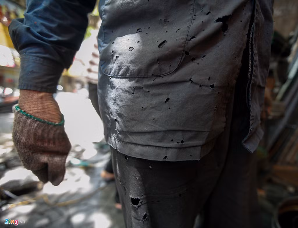 Bộ quần áo của ông Hùng thủng lỗ chỗ do những tia lửa bắn vào.