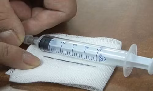 Soc voi chiec kim khau dai 4 cm trong co hong be gai 1 tuoi