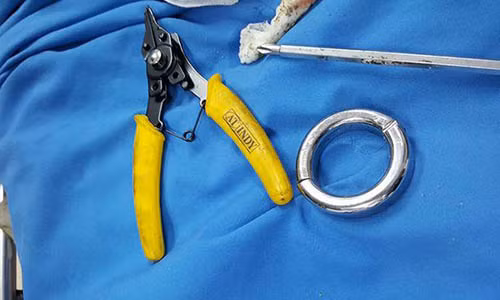 "Giai cuu cua quy" cua nguoi dan ong khoi do choi tinh duc