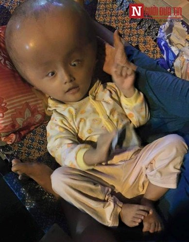 Roi nuoc mat voi than hinh 