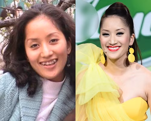 Khánh Thi có sự "lột xác" ngoạn mục về ngoại hình sau khi bọc răng sứ.