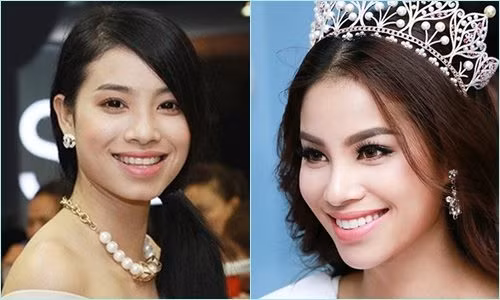 Để có được nụ cười tỏa nắng như hiện tại, Phạm Hương cũng đã nhờ đến sự can thiệp của các nha sĩ.