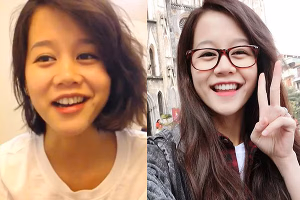 An Nguy từng sở hữu hàm răng khấp khểnh khiến cô không dám tự tin khi cười, sau khi chỉnh răng, cô nàng khoe nụ cười tỏa nắng khiến bao anh si mê.