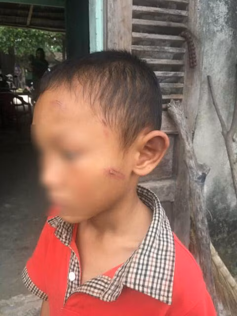 Phan no di ruot bao hanh be trai da man-Hinh-2