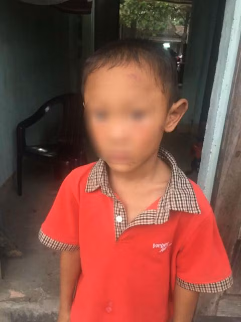 Phan no di ruot bao hanh be trai da man