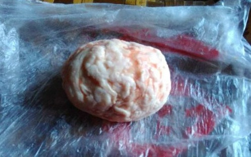 Phat hien “quai trung” cuc hiem trong ruot lon