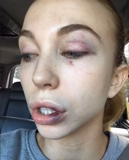 Ly do bat ngo vu thi sinh Hoa hau bi danh hoi dong