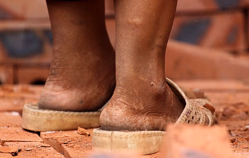 Các nữ công nhân không thể giữ được gót hồng.